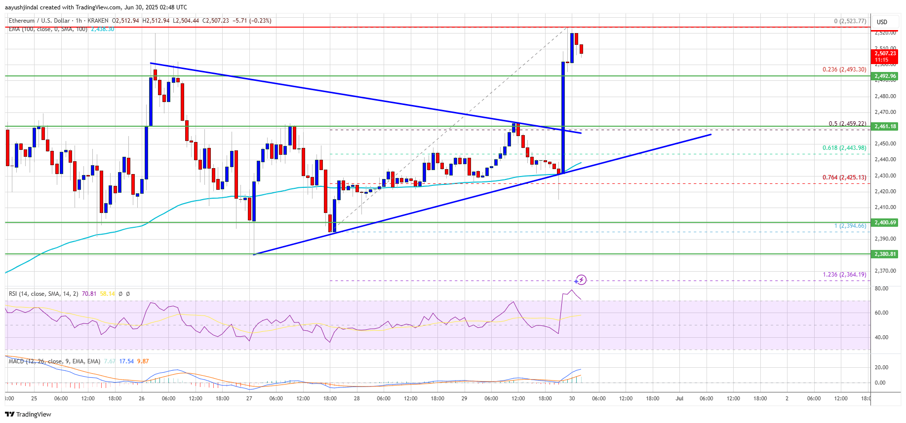 Ethereum Price Tests Resistance — Breakout Could Spark Rally