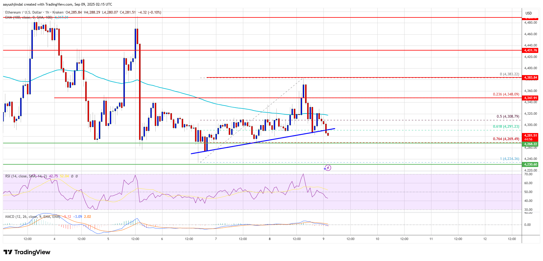 Ethereum Price Struggles Badly – More Downside Risk if Support Fails