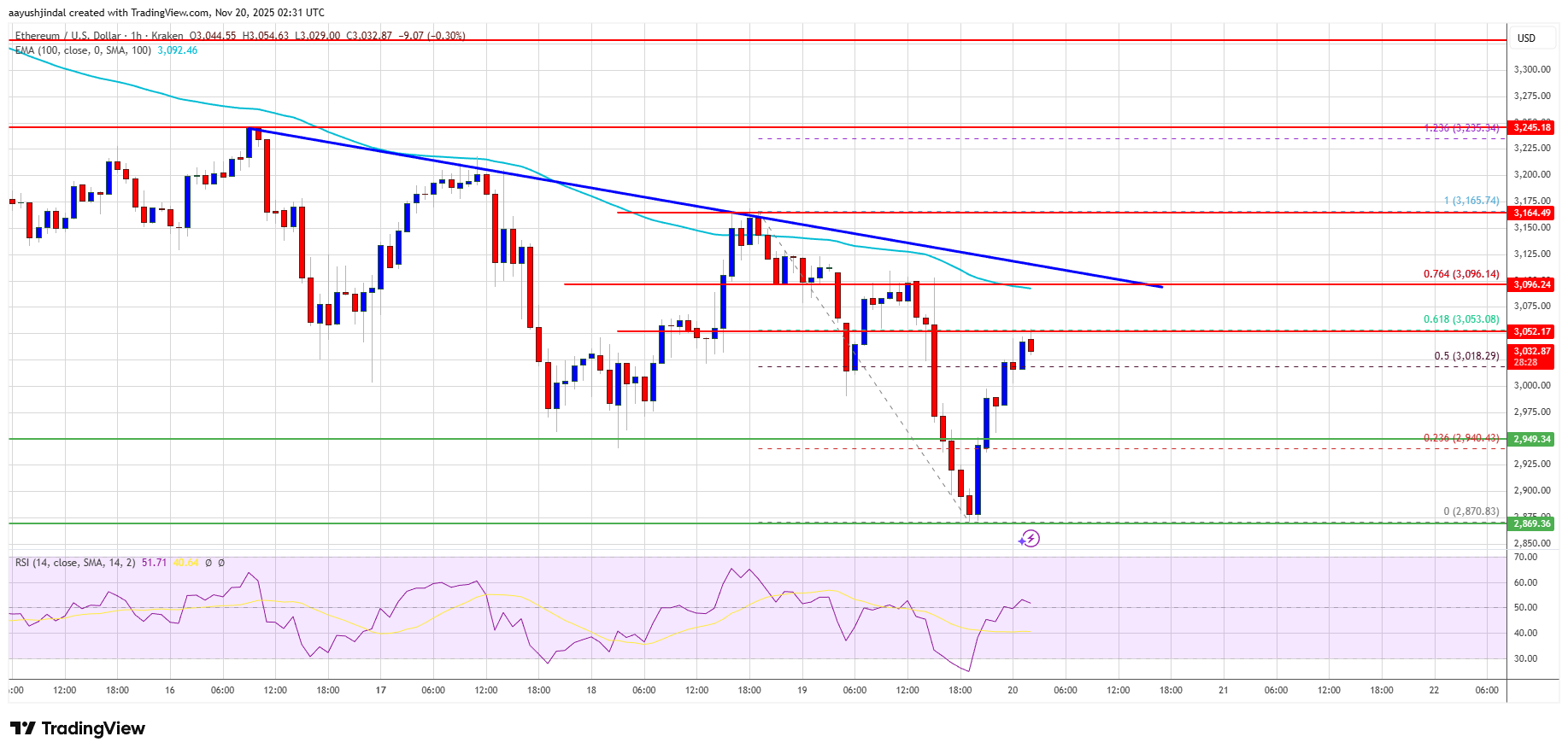 Ethereum Price Uphill Battle Continues as Sellers Hold the Advantage